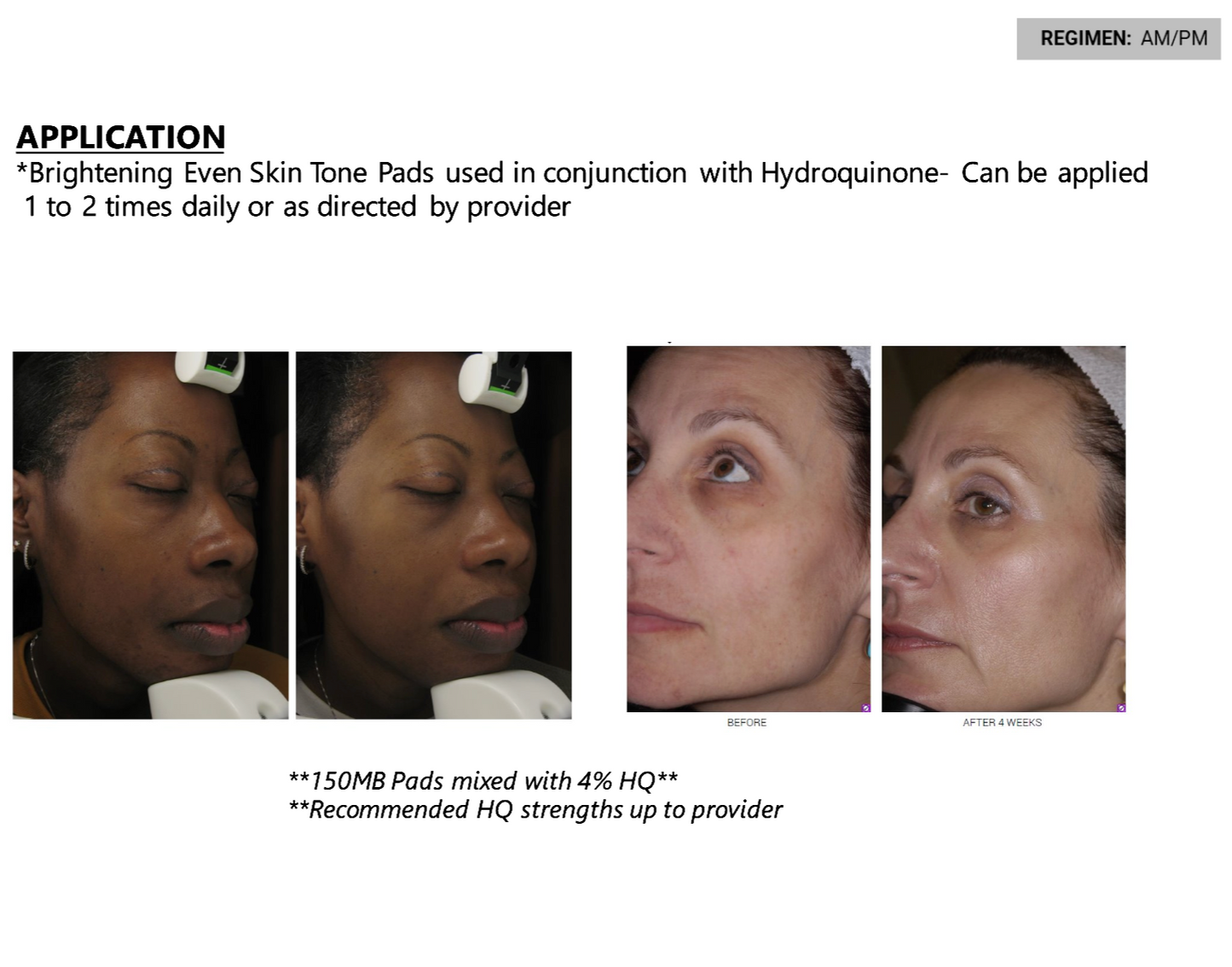 Super Brightening Pads Prescription-Strength With 2% Hydroquinone